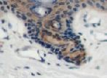 RSAD2 Rabbit Polyclonal Antibody