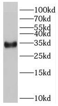 RSPO2 Rabbit Polyclonal Antibody