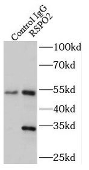 RSPO2 Rabbit Polyclonal Antibody