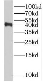 RSPO3 Rabbit Polyclonal Antibody