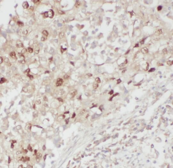 RSPO3 Rabbit Polyclonal Antibody