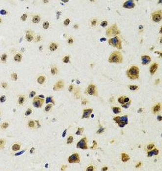 RUVBL2 Rabbit Polyclonal Antibody