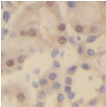 RXRA Rabbit Polyclonal Antibody