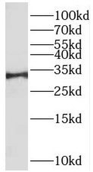 RYBP Rabbit Polyclonal Antibody