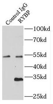 RYBP Rabbit Polyclonal Antibody