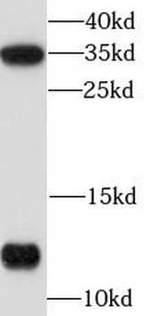S100A10 Rabbit Polyclonal Antibody