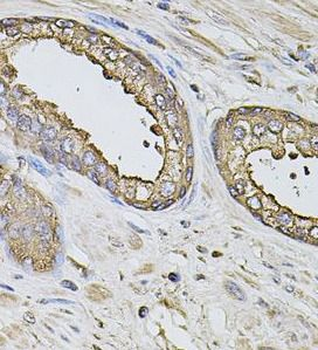 S100A12 Rabbit Polyclonal Antibody
