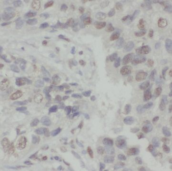 S100A16 Rabbit Polyclonal Antibody