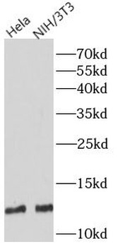 S100A4 Rabbit Polyclonal Antibody