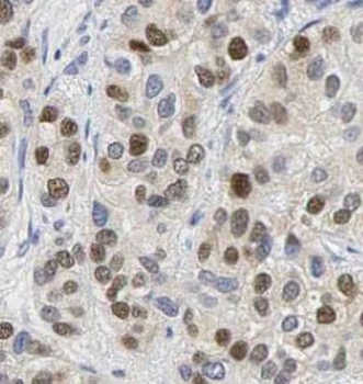 S100A4 Rabbit Polyclonal Antibody