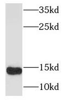 S100A9 Rabbit Polyclonal Antibody