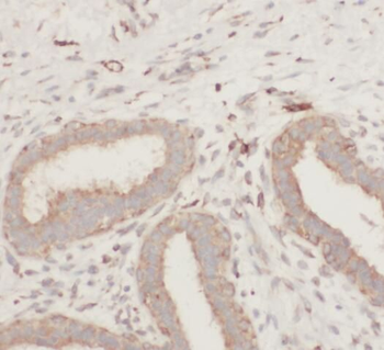 S100A9 Rabbit Polyclonal Antibody