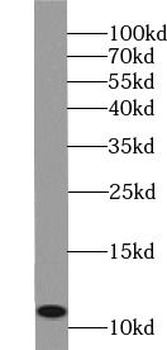 S100B Rabbit Polyclonal Antibody