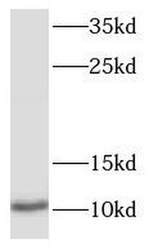S100P Rabbit Polyclonal Antibody