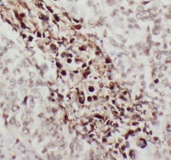 S100P Rabbit Polyclonal Antibody