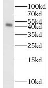 S1PR2 Rabbit Polyclonal Antibody