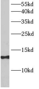 SAA4 Rabbit Polyclonal Antibody
