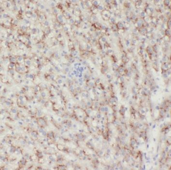 SAA4 Rabbit Polyclonal Antibody