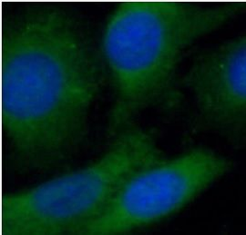 SACM1L Rabbit Polyclonal Antibody