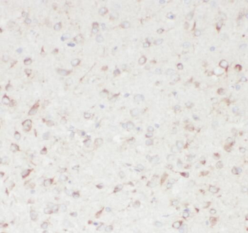 SACM1L Rabbit Polyclonal Antibody