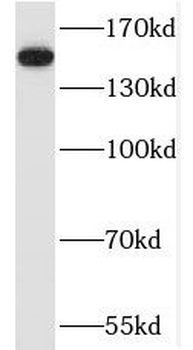 SAFB Rabbit Polyclonal Antibody