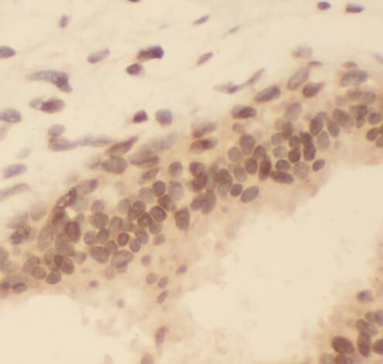 SAFB Rabbit Polyclonal Antibody