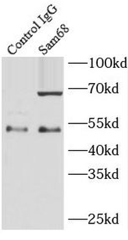 KHDRBS1 Rabbit Polyclonal Antibody