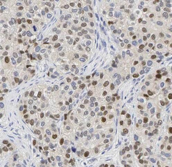 KHDRBS1 Rabbit Polyclonal Antibody