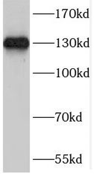 SAP130 Rabbit Polyclonal Antibody