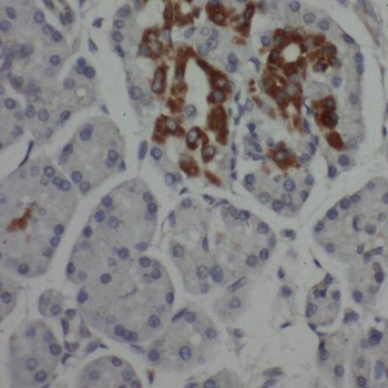 SAP130 Rabbit Polyclonal Antibody