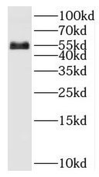 SARS2 Rabbit Polyclonal Antibody