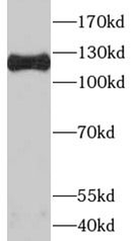 SART3 Rabbit Polyclonal Antibody