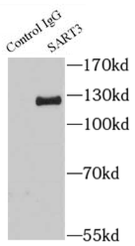 SART3 Rabbit Polyclonal Antibody