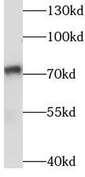 SASS6 Rabbit Polyclonal Antibody