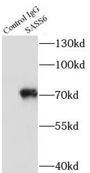 SASS6 Rabbit Polyclonal Antibody