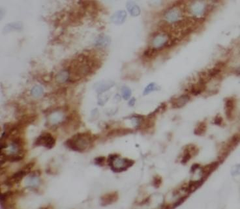 SASS6 Rabbit Polyclonal Antibody