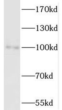 SATB1 Rabbit Polyclonal Antibody