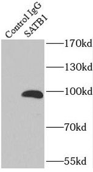 SATB1 Rabbit Polyclonal Antibody