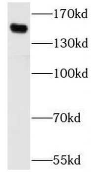 SBNO1 Rabbit Polyclonal Antibody