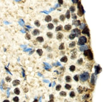 SBNO1 Rabbit Polyclonal Antibody