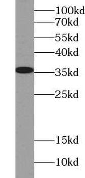 CLEC11A Rabbit Polyclonal Antibody