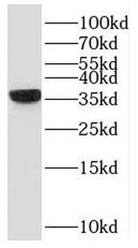SCGN Rabbit Polyclonal Antibody