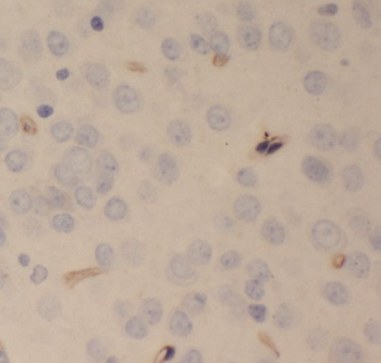 SCHIP1 Rabbit Polyclonal Antibody