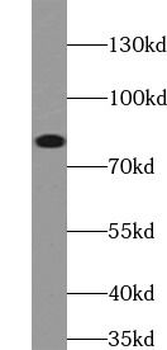 SCIN Rabbit Polyclonal Antibody