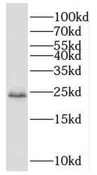 SCML1 Rabbit Polyclonal Antibody