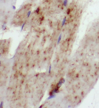 SCN4B Rabbit Polyclonal Antibody