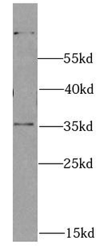 SCO1 Rabbit Polyclonal Antibody