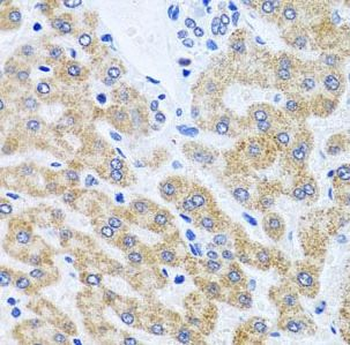 SCO1 Rabbit Polyclonal Antibody