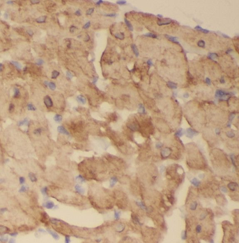 SCO2 Rabbit Polyclonal Antibody