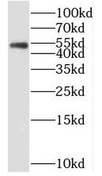ENTR1 Rabbit Polyclonal Antibody
